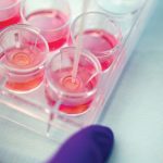 SafetySkinIrritation-9406